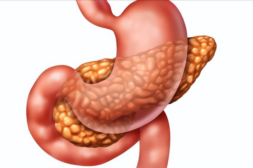 癌症的发病原因及其如何预防,癌症都是先由炎症引起的吗