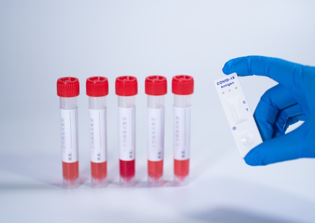 抗原试剂要买今年的吗,抗原试剂有风险吗