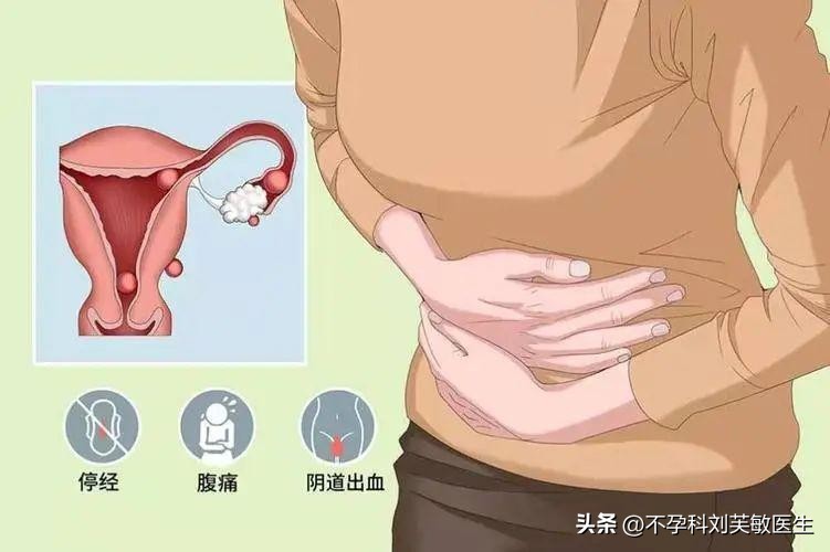 阴道不正常出血有什么症状,阴道不规律的出血有些什么症状