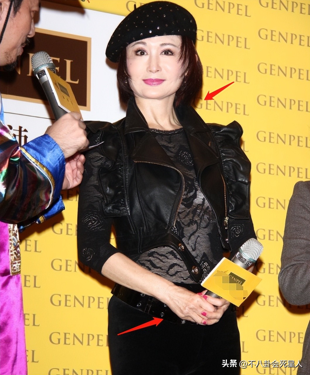 拉皮的女明星后遗症,拉皮失败的明星