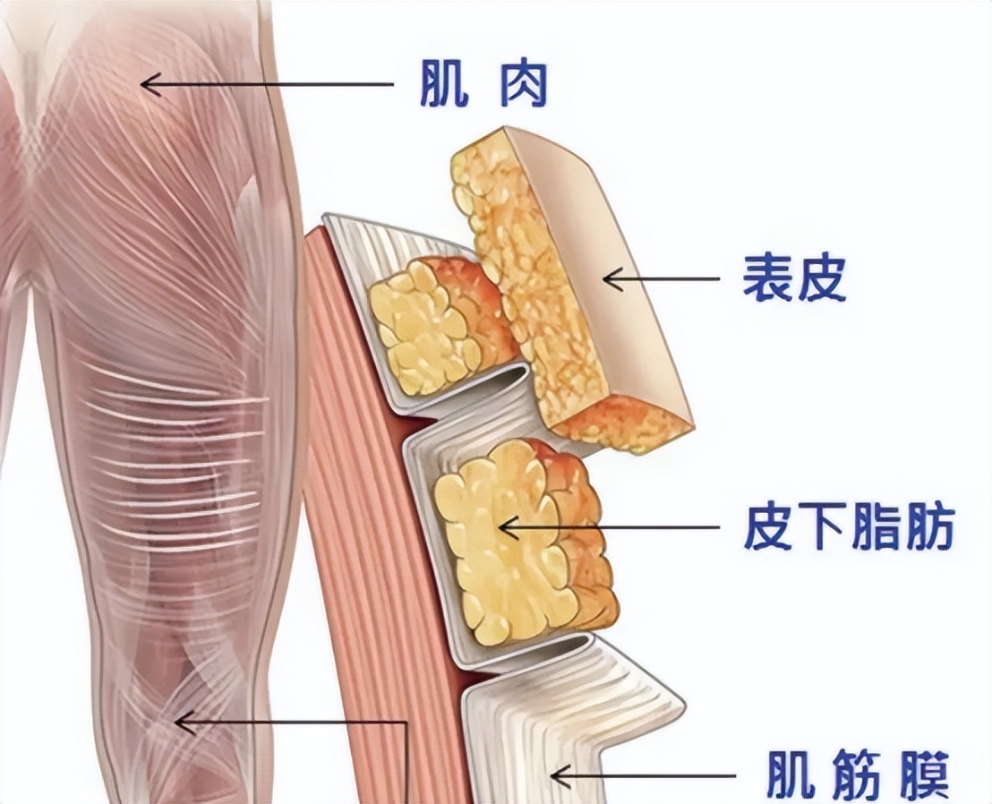 筋膜枪的作用和使用方法,筋膜枪的副作用和危害