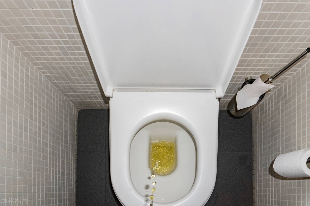 早上上厕所尿液什么颜色是正常的,从尿液看身体健康状况