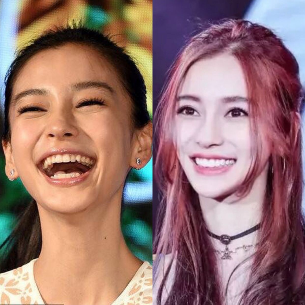 比“牙黄”更可怕的是“牙龈外露”，一笑就破功，很多明星都中招