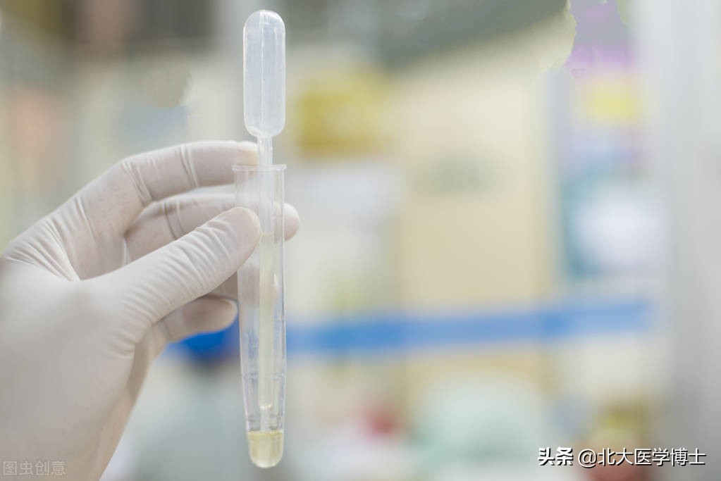 尿酸高尿酸碱度6.0需要喝小苏打吗,尿酸痛风吃小苏打可以降尿酸吗