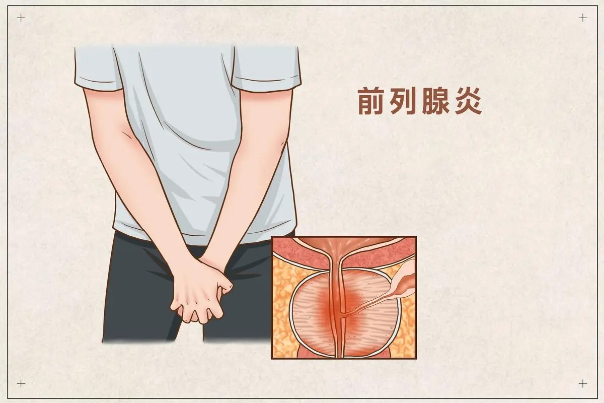 最伤男人前列腺的6种习惯,前列腺疾病和卫生习惯