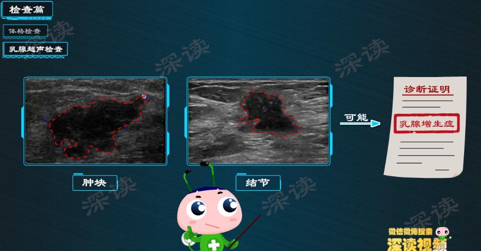 乳房有点增生怎么办,螺内酯副作用乳腺增生