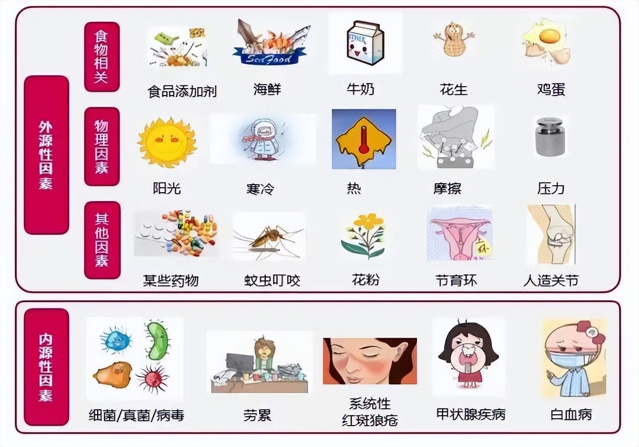 荨麻疹常识,荨麻疹知识