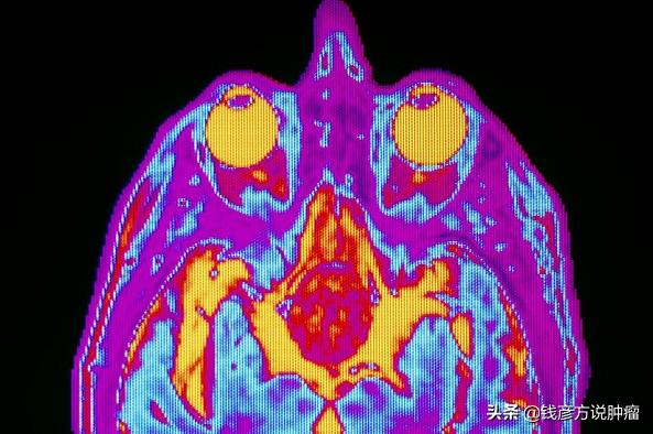 头晕被诊断为脑梗死危险吗,头晕轻度高血压该怎么办