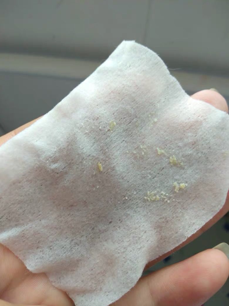 鼻子毛孔大能挤出好多脂肪粒,鼻子上长了像脂肪粒的东西