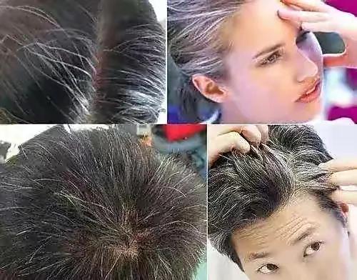 白发越拔越多是有根据的,白发真的会越拔越多嘛