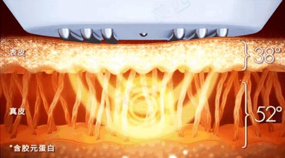 痘痘痘印痘坑改善全过程,学生祛痘痘和痘印痘坑简单的方法