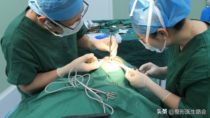 膨体隆鼻6年亲身经历,膨体隆鼻一年后的真实感言