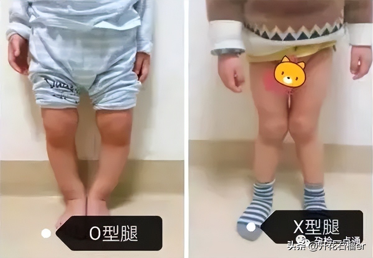 小月龄宝宝习惯把屎把尿如何纠正,8个月宝宝把屎把尿到底好不好