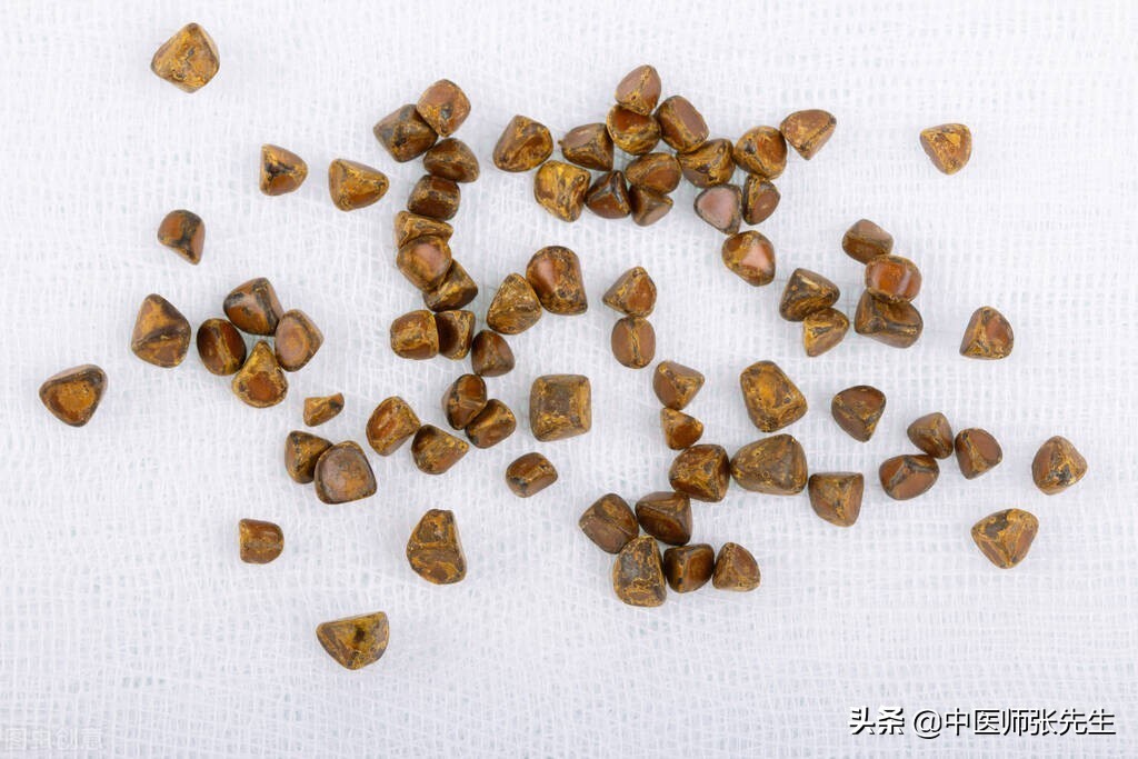 中医说结石是什么原因造成的,中医认为结石是什么原因引起的