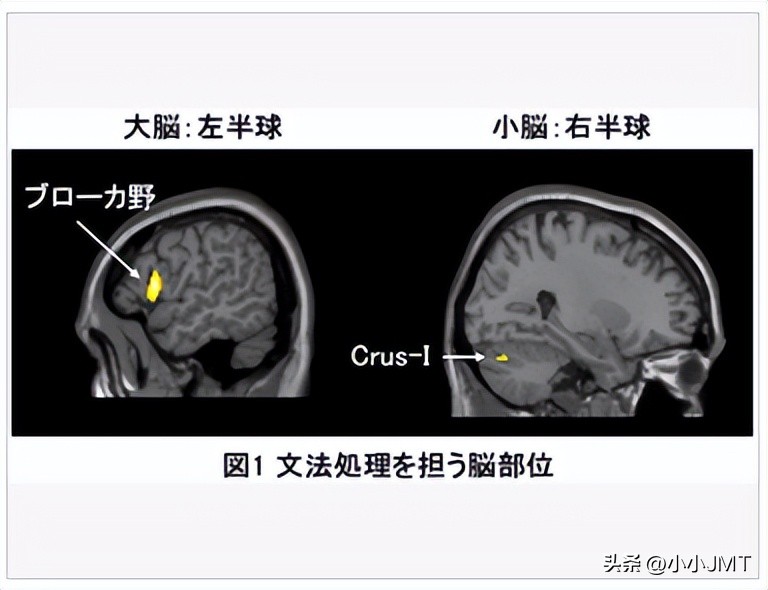 大脑跟语言处理相关的脑区,小脑半球大脑半球
