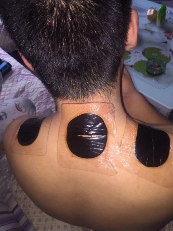 全球唯一可以治愈骨关节炎的药物,骨关节炎特效药最新研究