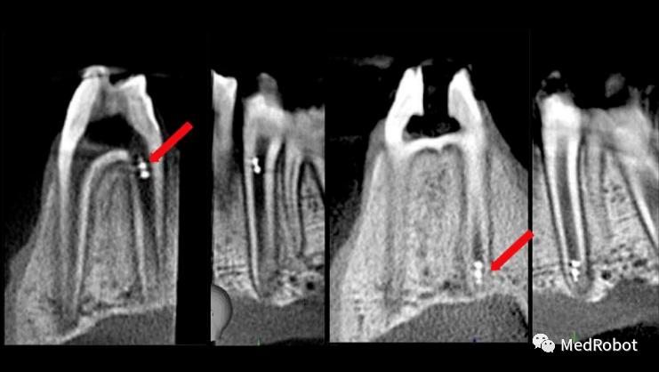 微型机器人应用,微型细胞机器人