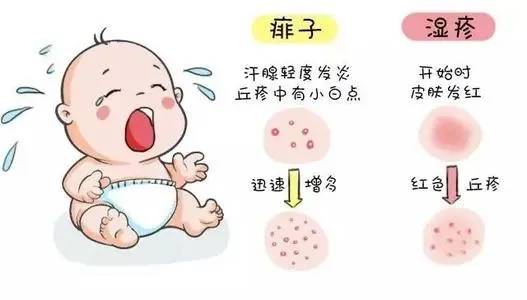 宝宝热的头上长痱子,天热长痱子擦什么最好用