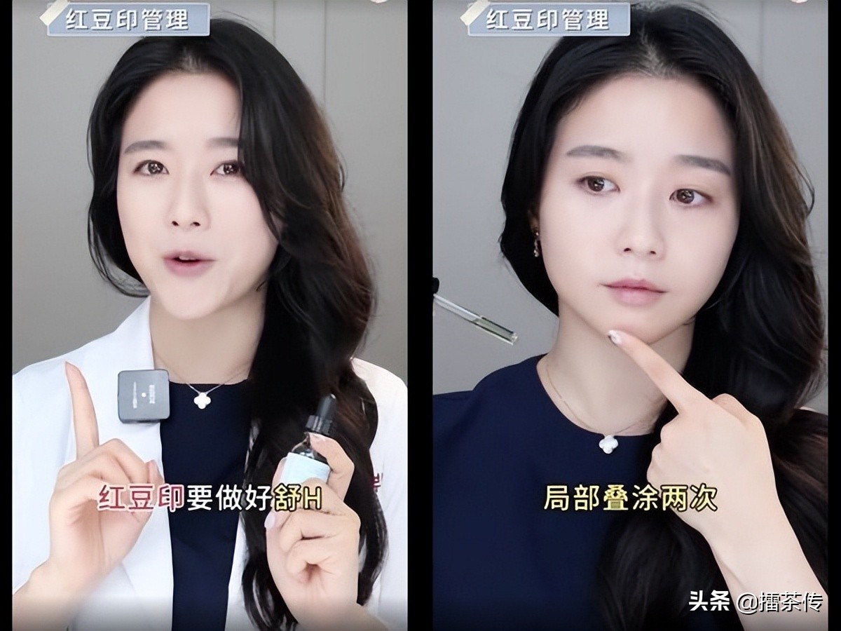 痘疤用什么药膏祛痘好用,痘疤脸怎么护肤