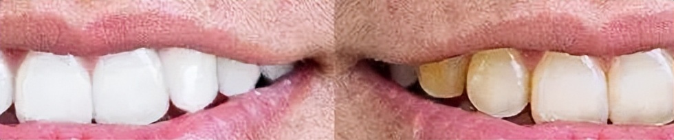 ps磨皮插件dr5能处理疤痕吗,dr5磨皮插件哪个版本最好