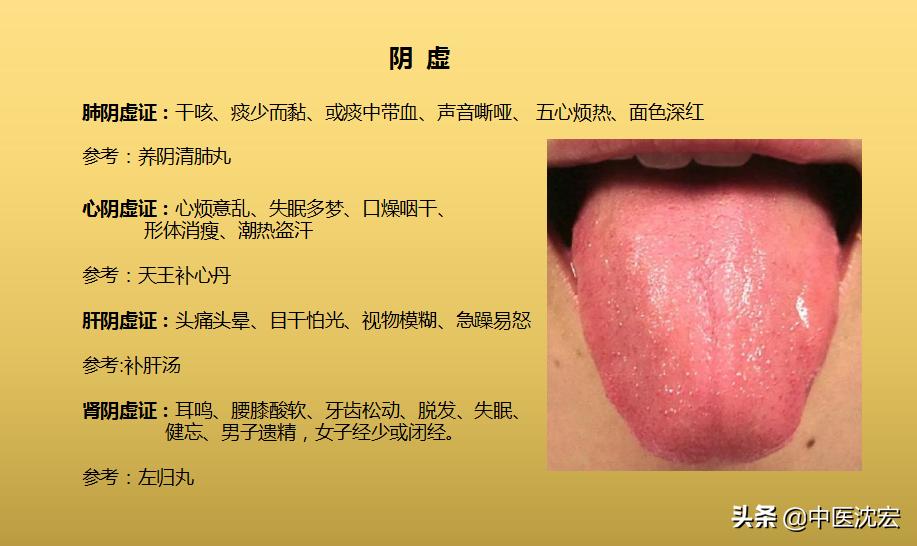 气虚阳虚内热的症状,阴虚内热气虚体质怎么调理