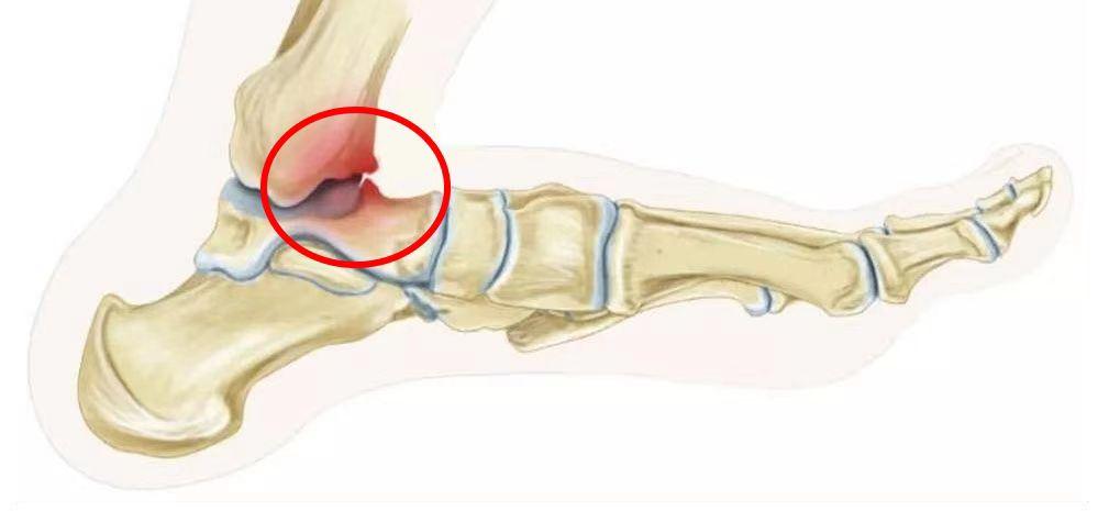 看足球看球,看足球注意事项