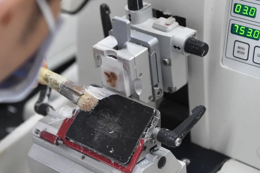 医生说病理报告有点小问题,病理报告没出来好害怕啊