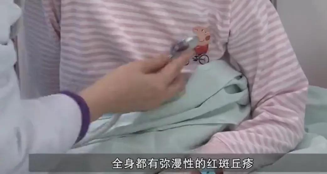 被毒虫咬后需谨慎,被毒虫咬后的有效处理