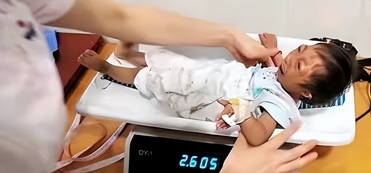 袖珍人梁小小刚刚出生的样子,袖珍女孩梁小小现在长大的样子