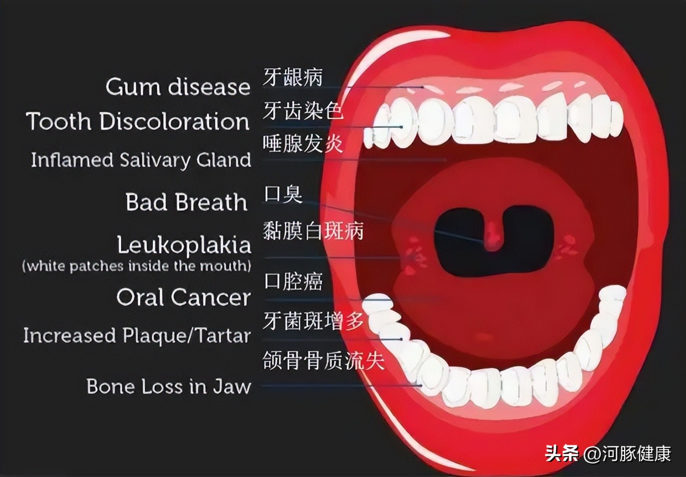 长期口腔溃疡不疼不痒,长期口腔溃疡不愈合会怎样