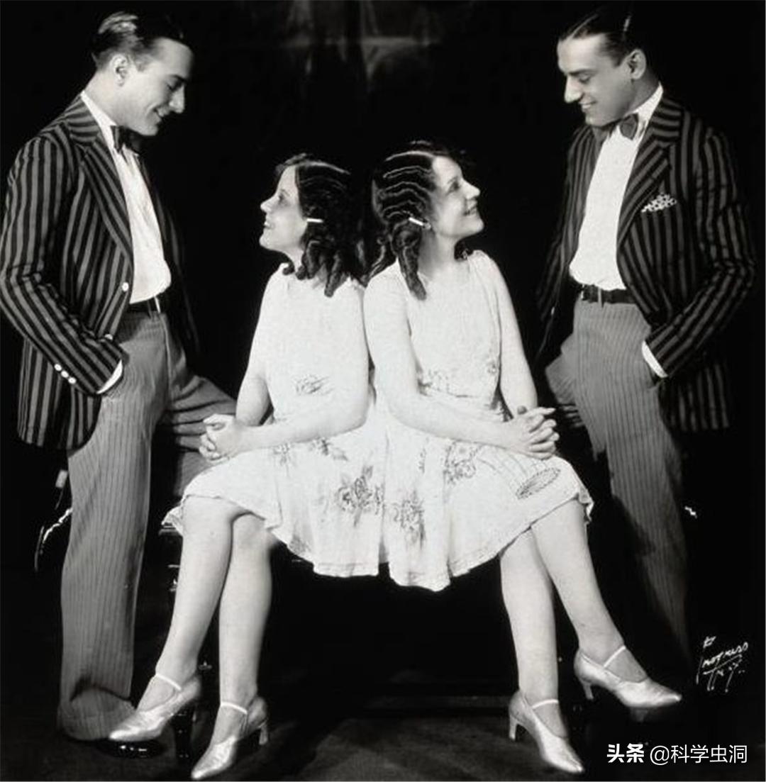 连体姐妹其中一个人死了怎么办,连体姐妹一个死了另一个咋办