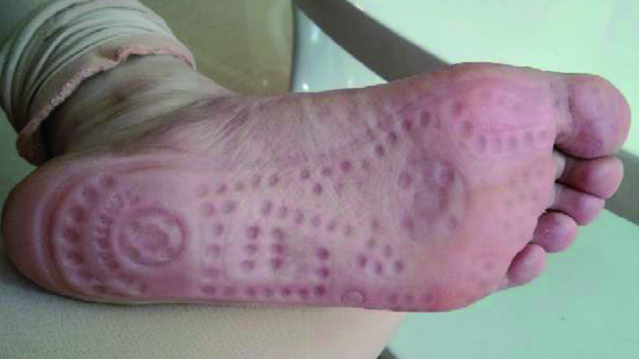 足底保健按摩袜,足疗保健袜