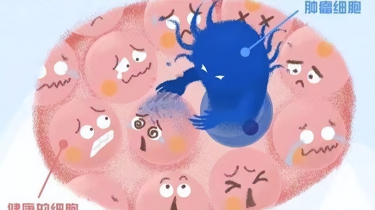 乳腺癌术后复查中需要注意哪些问题？