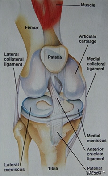半月板后角撕裂微创手术,半月板撕裂分型