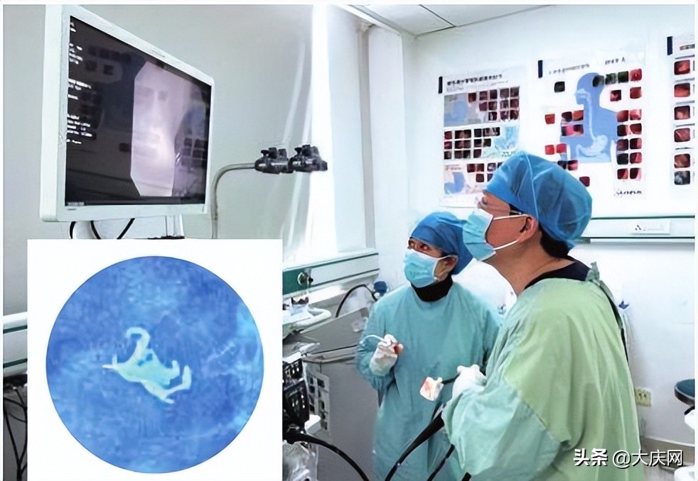 八旬老太误吞假牙医生成功取牙,女子误吞假牙医生跪地