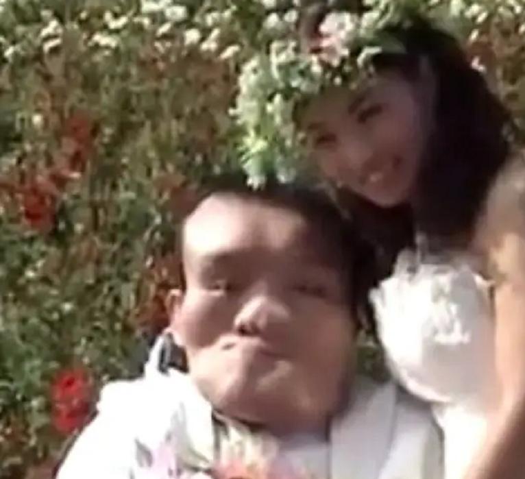 男孩得了怪病头部巨大,男孩得了怪病只有半个头