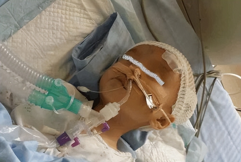 可怜的孩子输液,可怜的婴儿打针输液