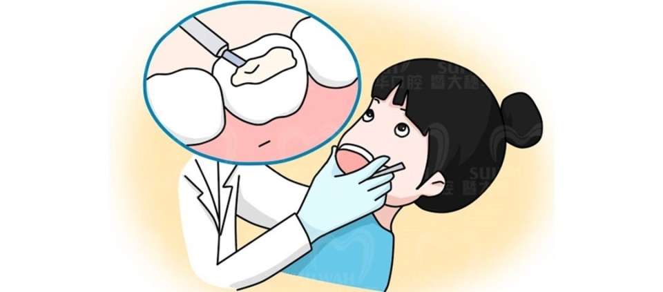 牙疼怎么辨别是哪种牙病,牙疼怎么判断是上火还是有炎症