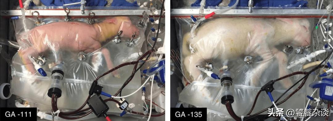 以后会有人工子宫吗,人工子宫多久能普及