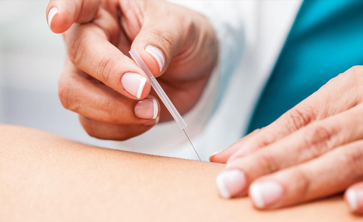 中医针灸治疗腰痛病的学术思想,古法针灸临床治验