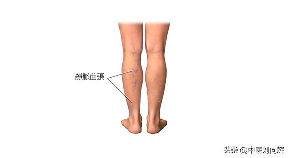 血府逐瘀大药丸哪家最好用,什么牌子的血府逐瘀丸效果好