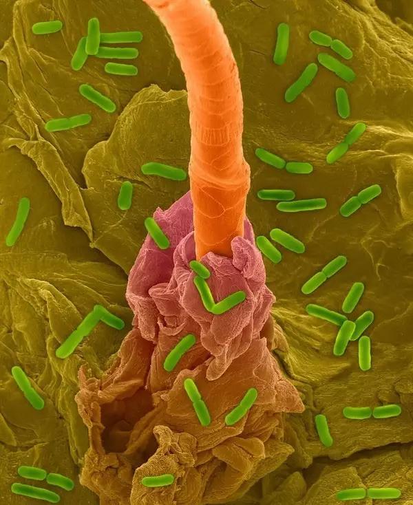 革兰氏阳性孢子,革兰氏阳性孢子菌