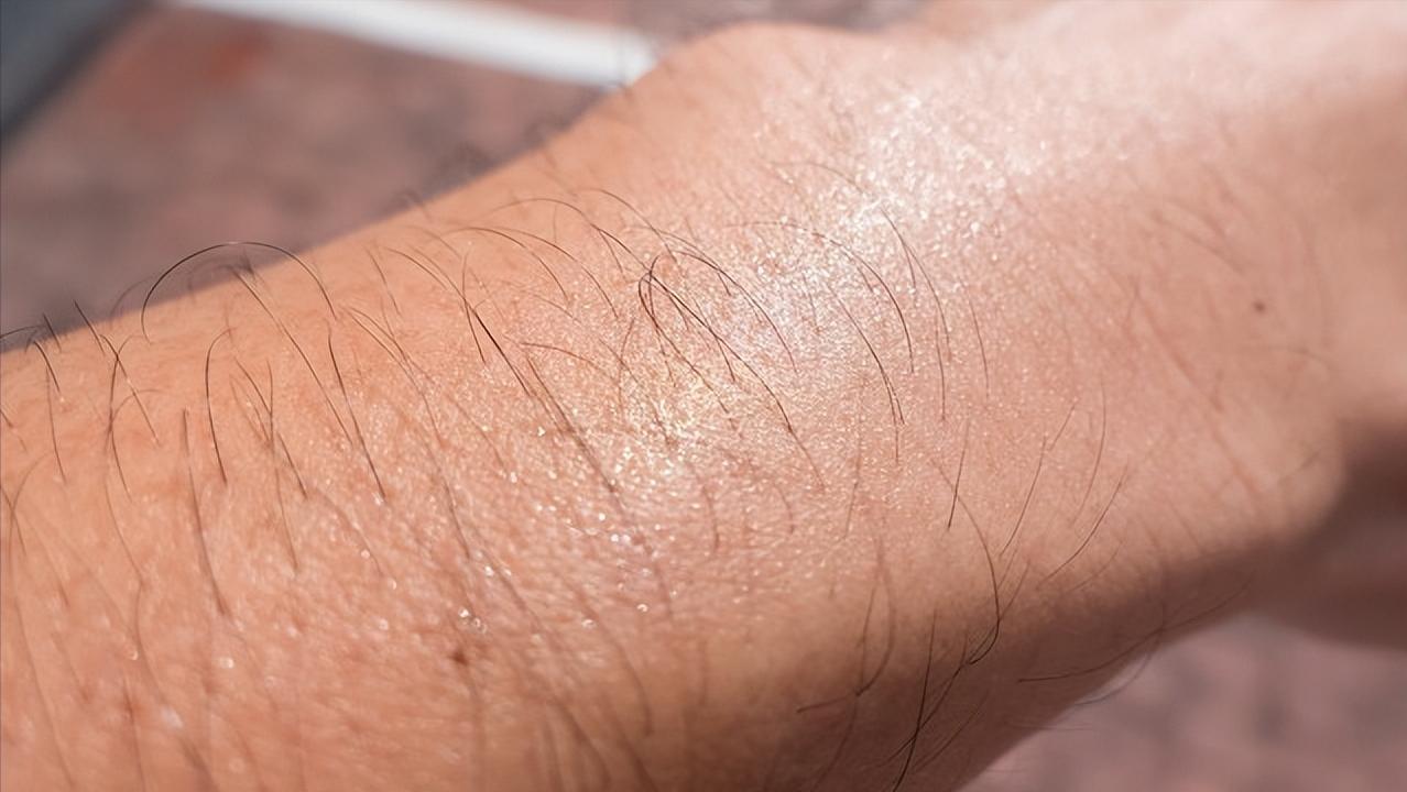 47岁女子阴毛变白和性功能有关系吗？医生：这是正常的衰老现象