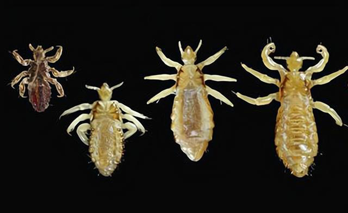 虱子在头上有什么危害,虱子对人体有哪些害处