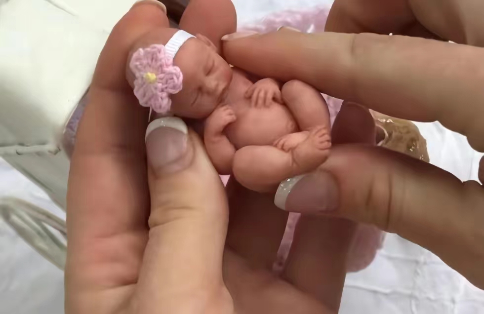 美国真实版拇指姑娘,拇指姑娘出生时图片