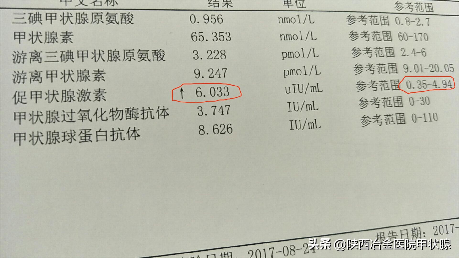 tsh促甲状腺激素偏高会有什么危害,促甲状腺激素tsh偏高能根治吗