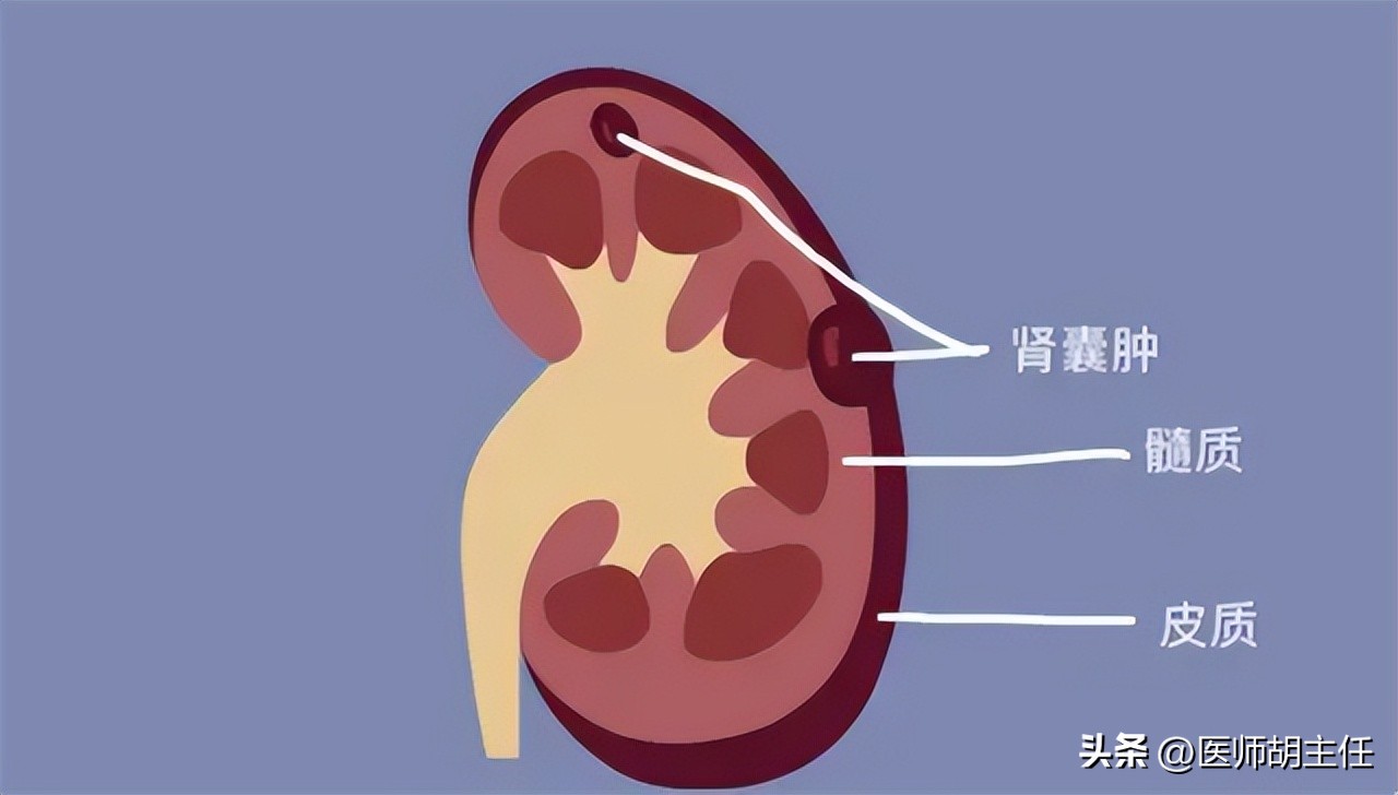 体检肝部囊肿最大2.8怎么办,体检发现肝囊肿肾囊肿