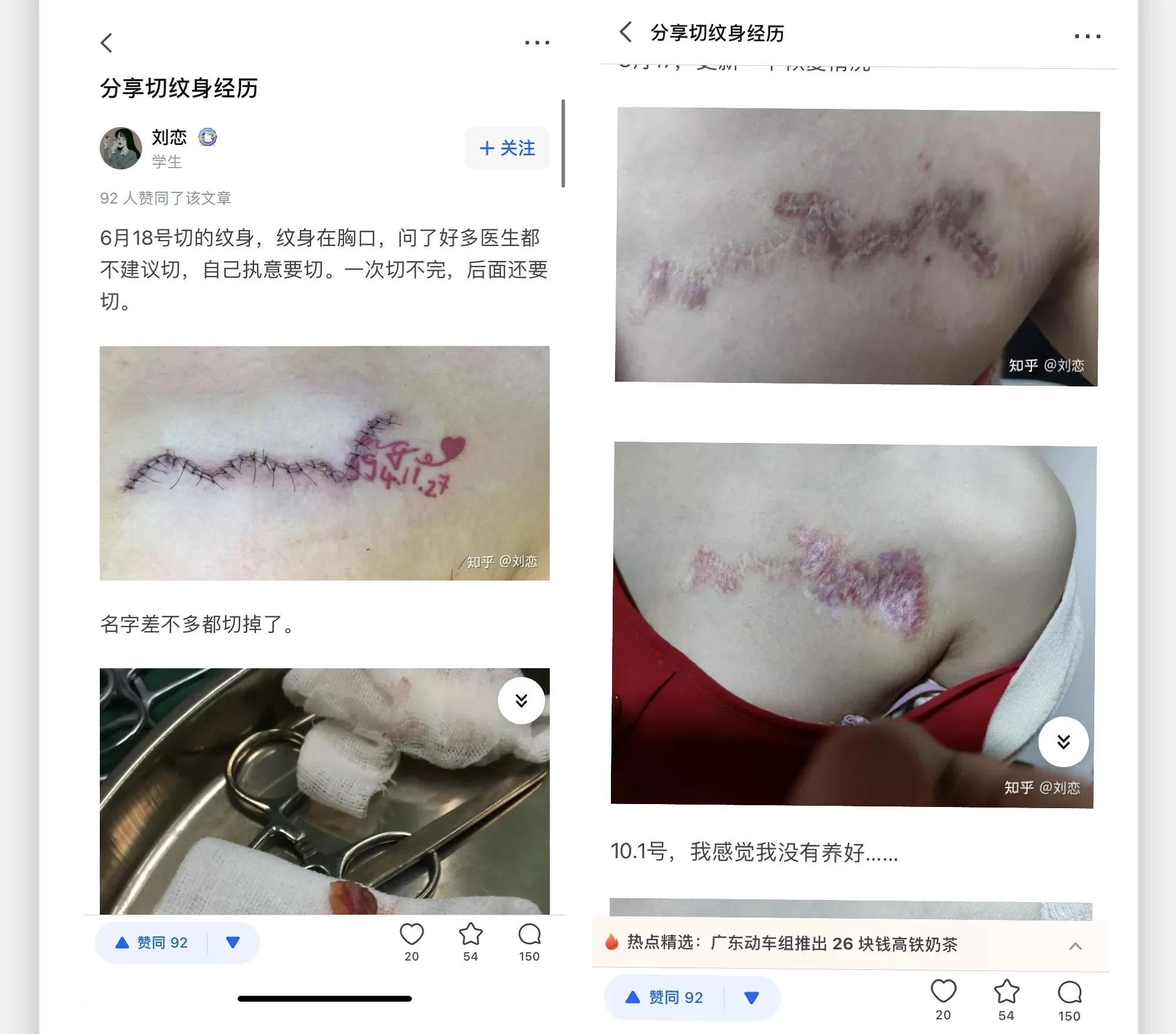为洗纹身买单,洗纹身有什么代价