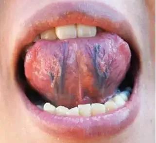 女性调经最有效的药品益母草,益母草怎么使用可以调经治痛经