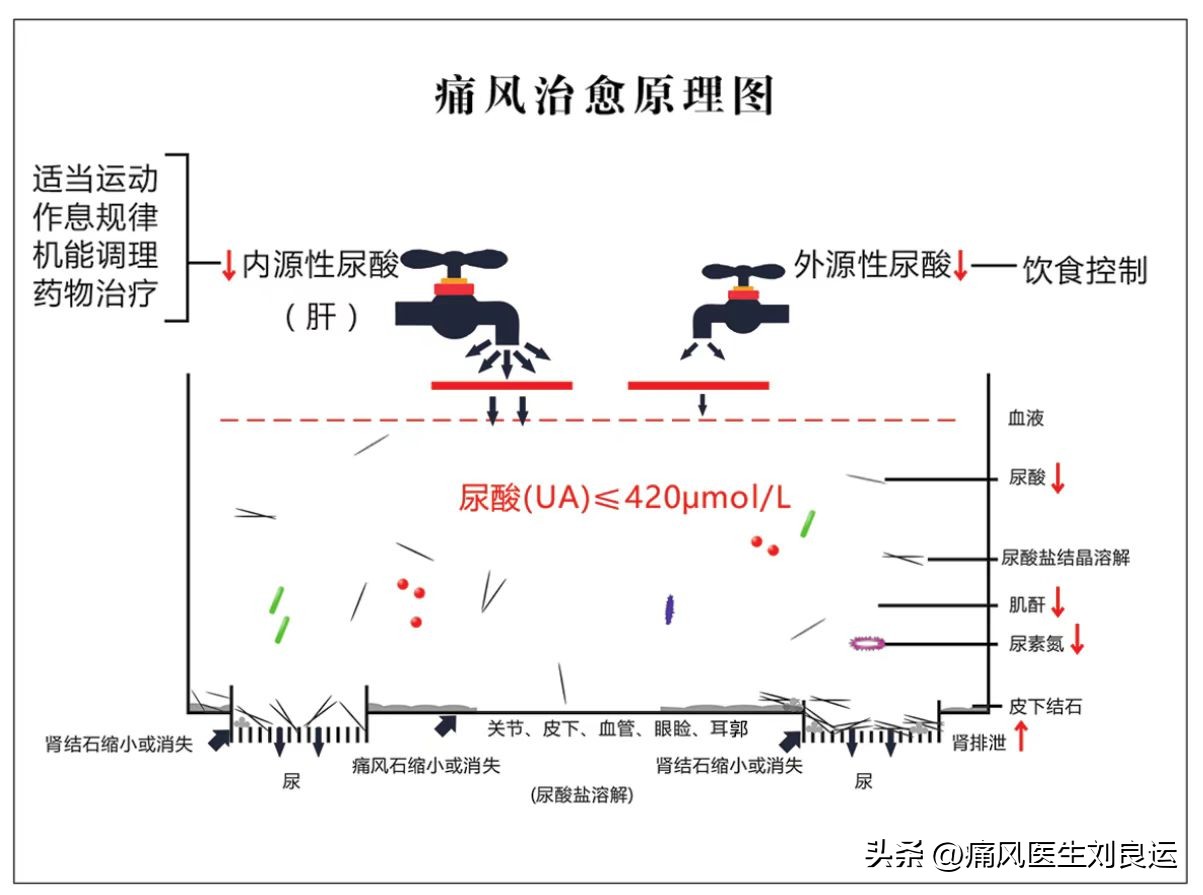 痛风尿酸平稳可停药吗,痛风有救了才10天尿酸就降下来了